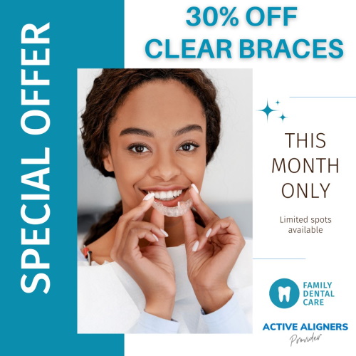 30 off clear braces hilton kzn